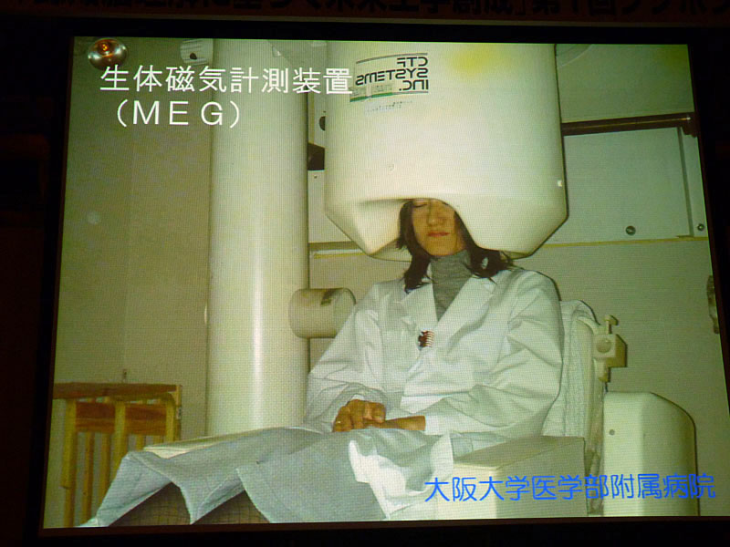 生体磁気計測装置(MEG)