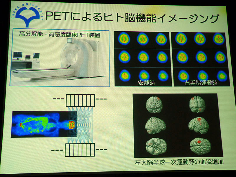 PETを使った脳機能イメージング